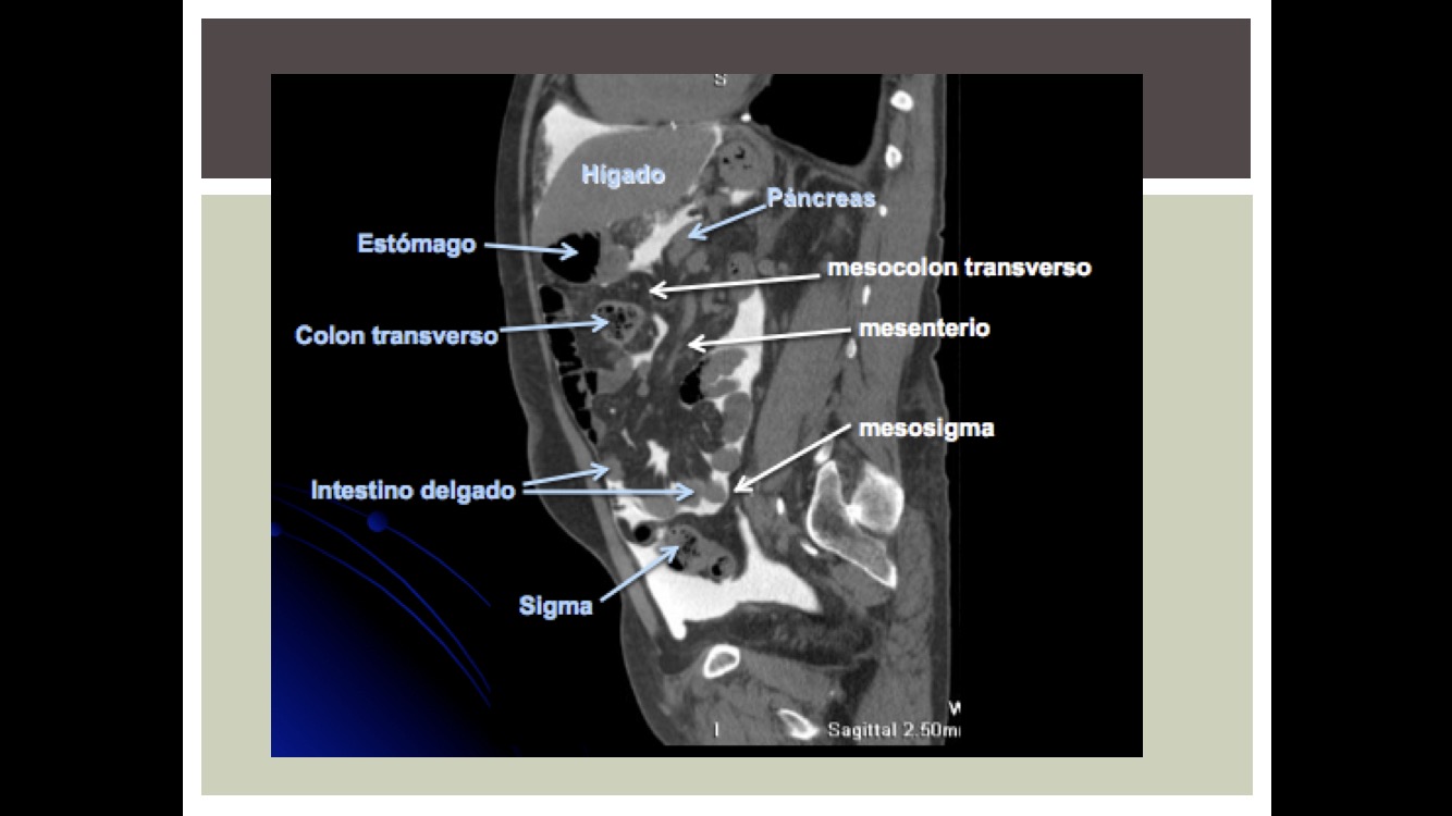 ExposiciÃ³n de AnatomÃ­a espacios peritoneales, retroperitoneo por tomografÃ­a (tac) PDF