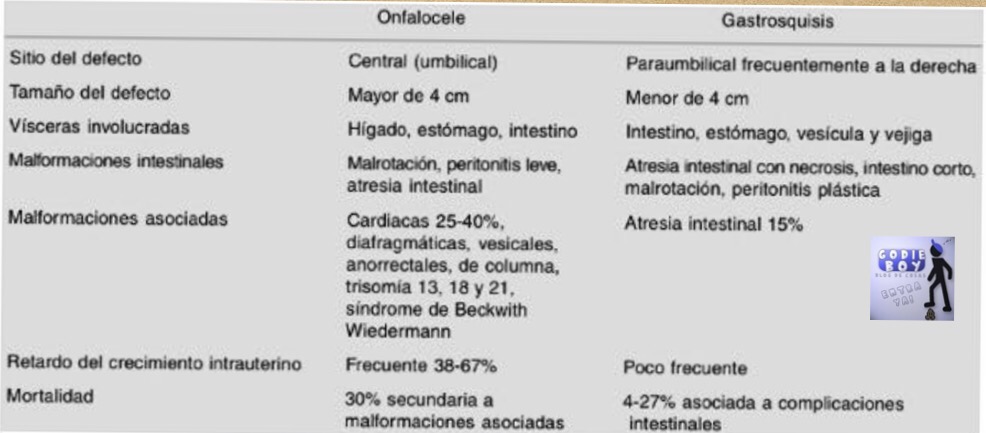Diferencias entre la gastrosquisis y el onfalocele