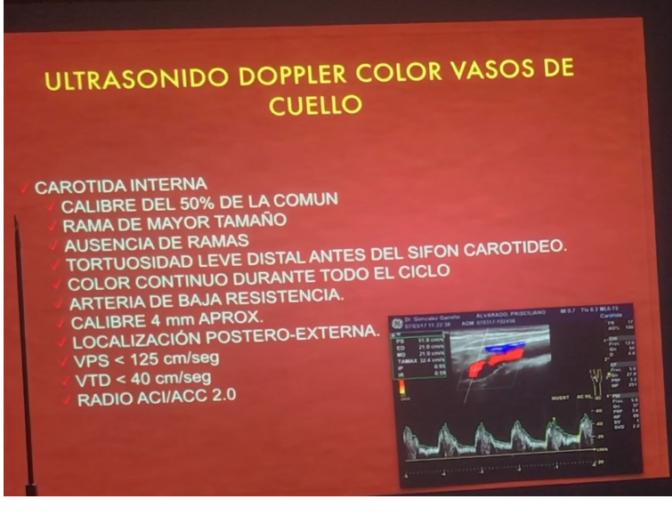 CaracterÃ­sticas del ultrasonido  Doppler de la arteria carotida Interna