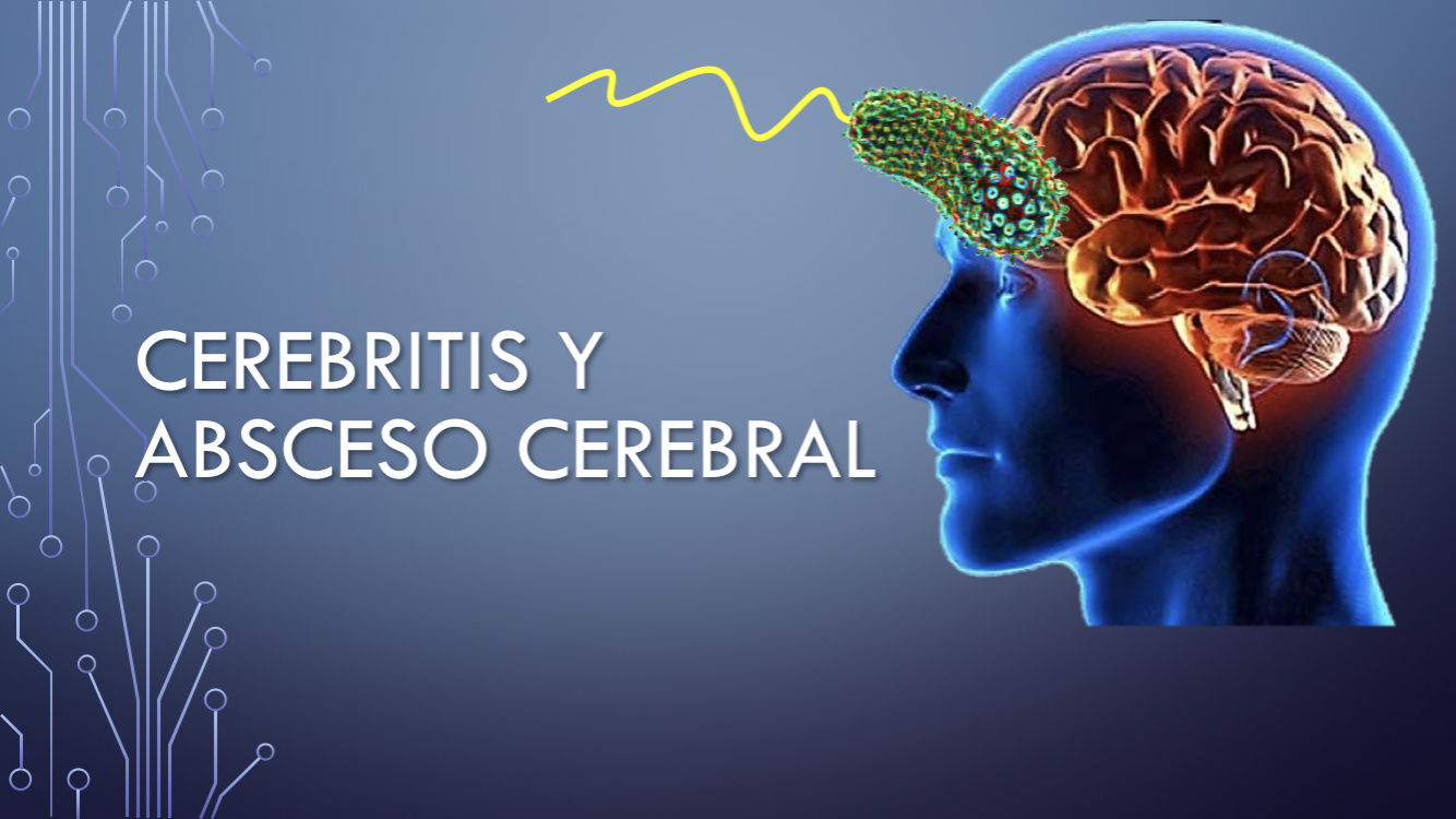 CASO CLINICO DE NEUROLOGIA CEREBRITIS Y ABSCESO CEREBRAL