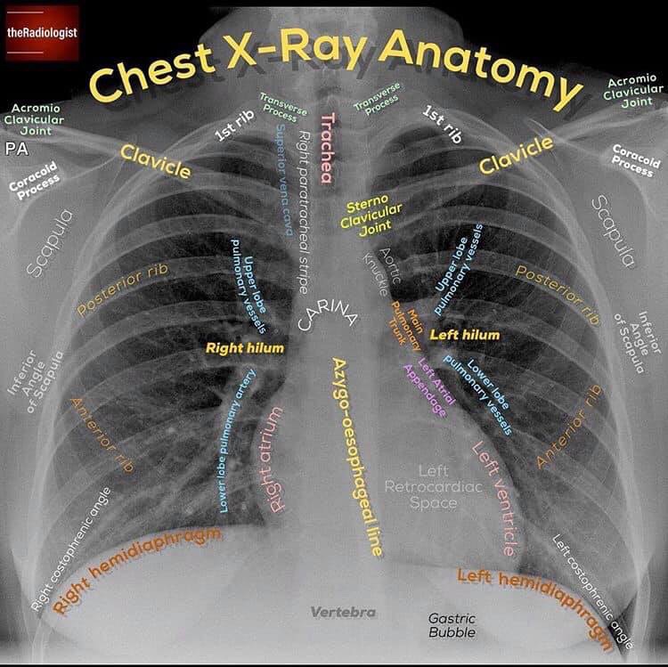 Radiologia convencional y anatomÃ­a